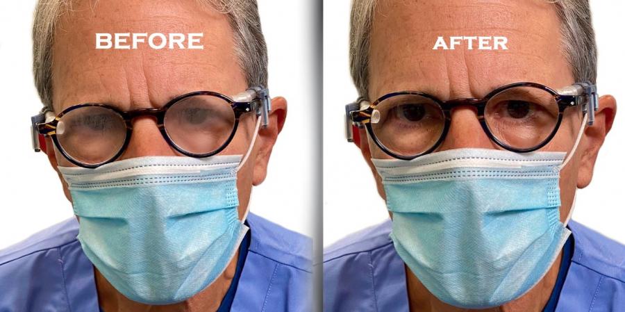 FogFree EyeWear