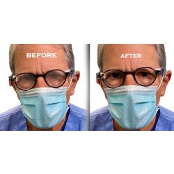 FogFree EyeWear